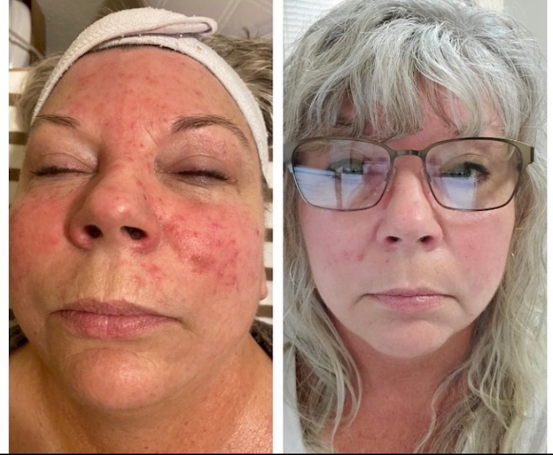 Glow Life Advanced Esthetics