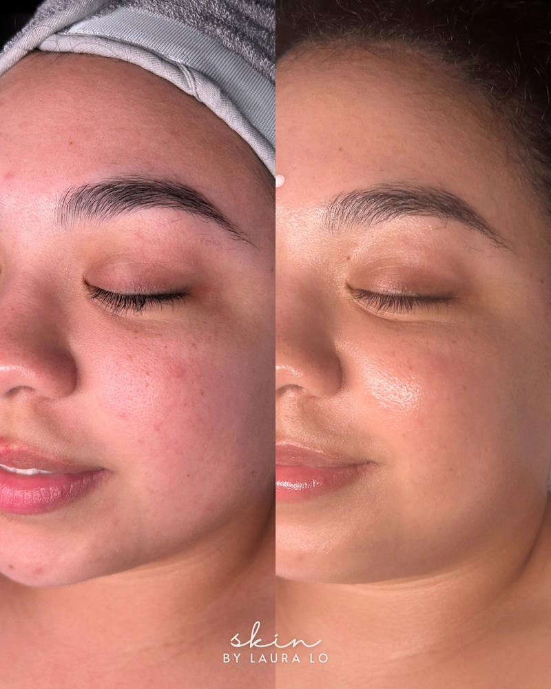 Skin by Laura Lo
