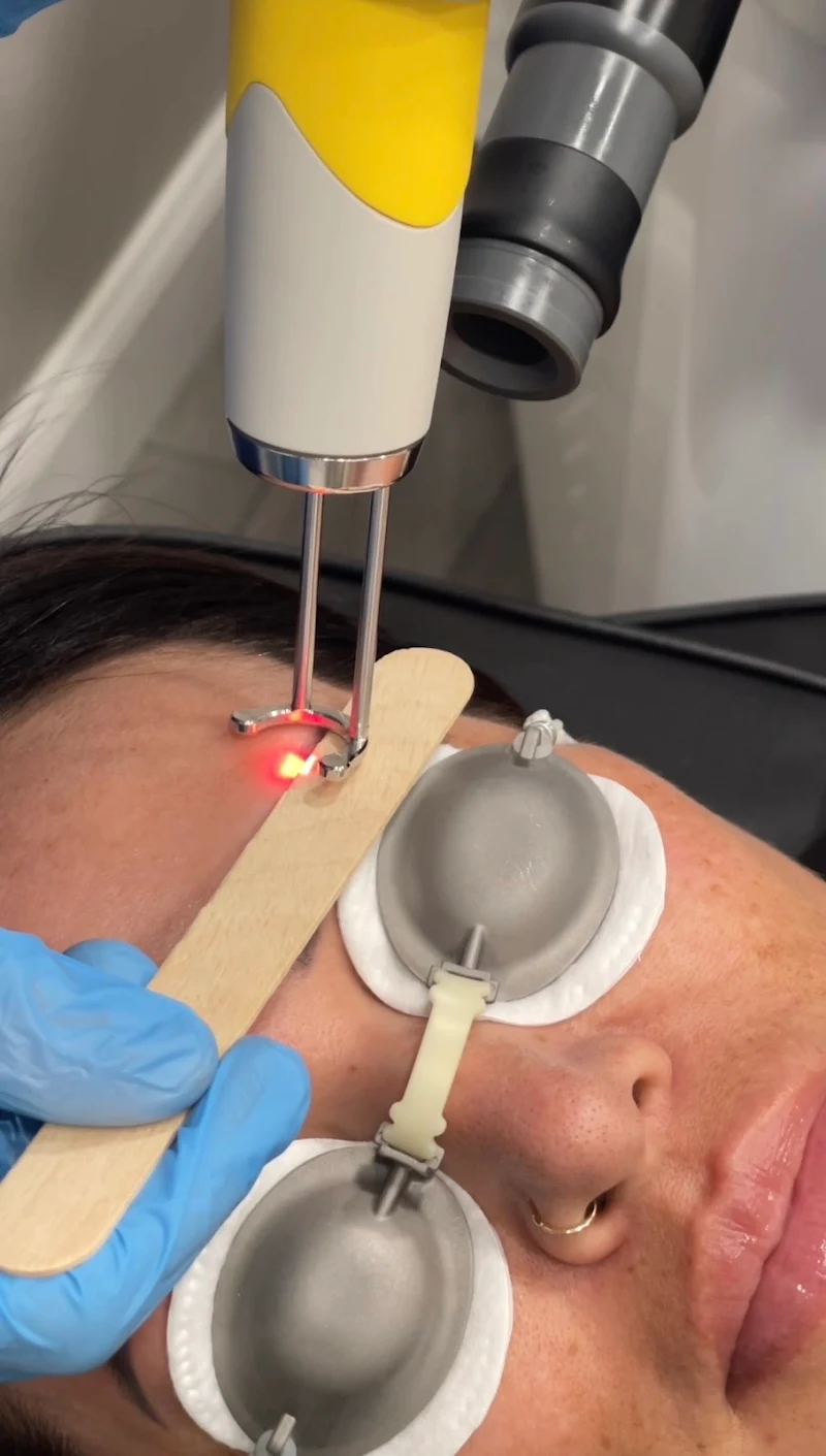 Tampa Bay Tattoo Removal