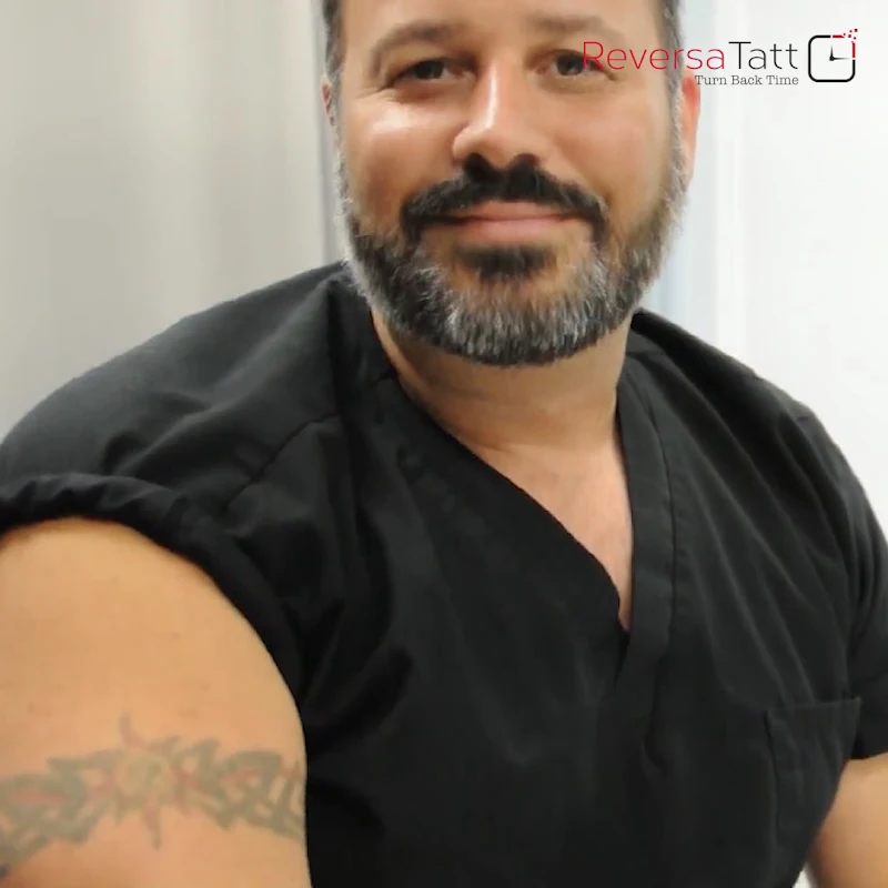 ReversaTatt Tattoo Removal photo 2