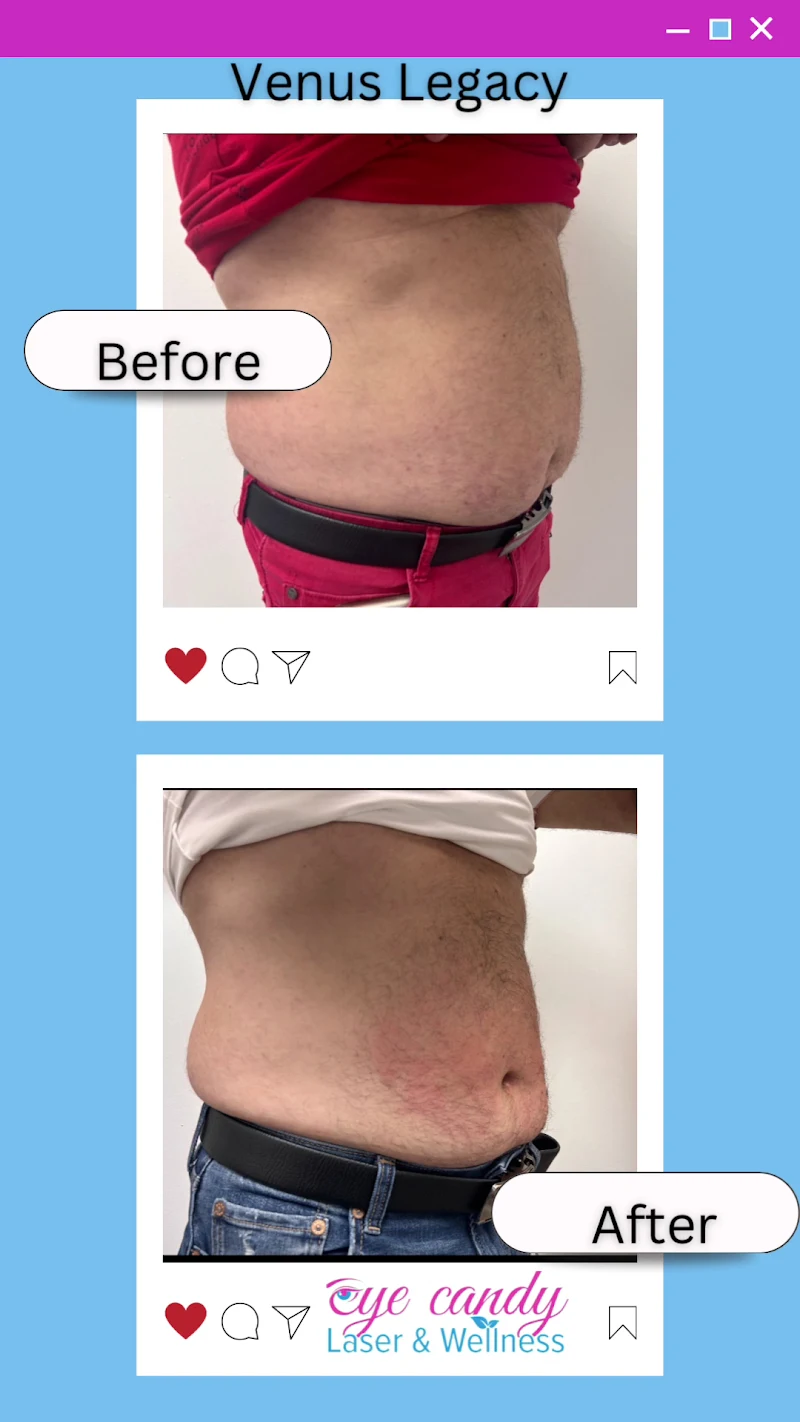 Eye Candy Laser & Wellness Tampa photo 2