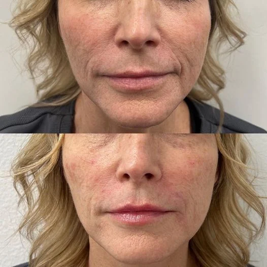 AgeRejuvenation - Brandon