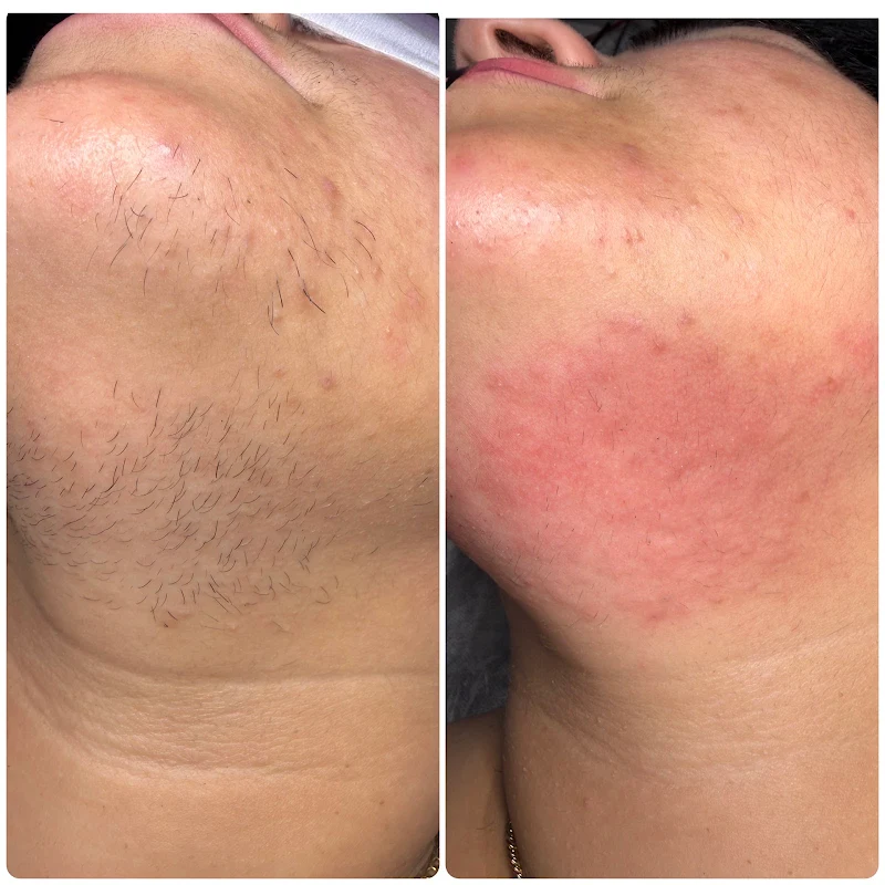 FLASH Electrolysis & Skin Care