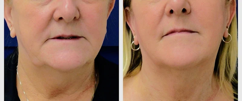 Laser Skin Care by Melinda
