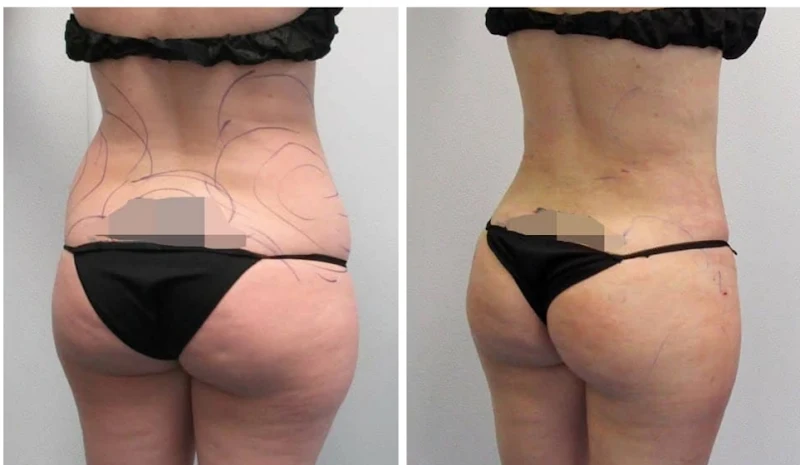 Gruber Plastic Surgery