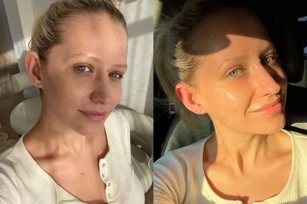 Lux Injectables