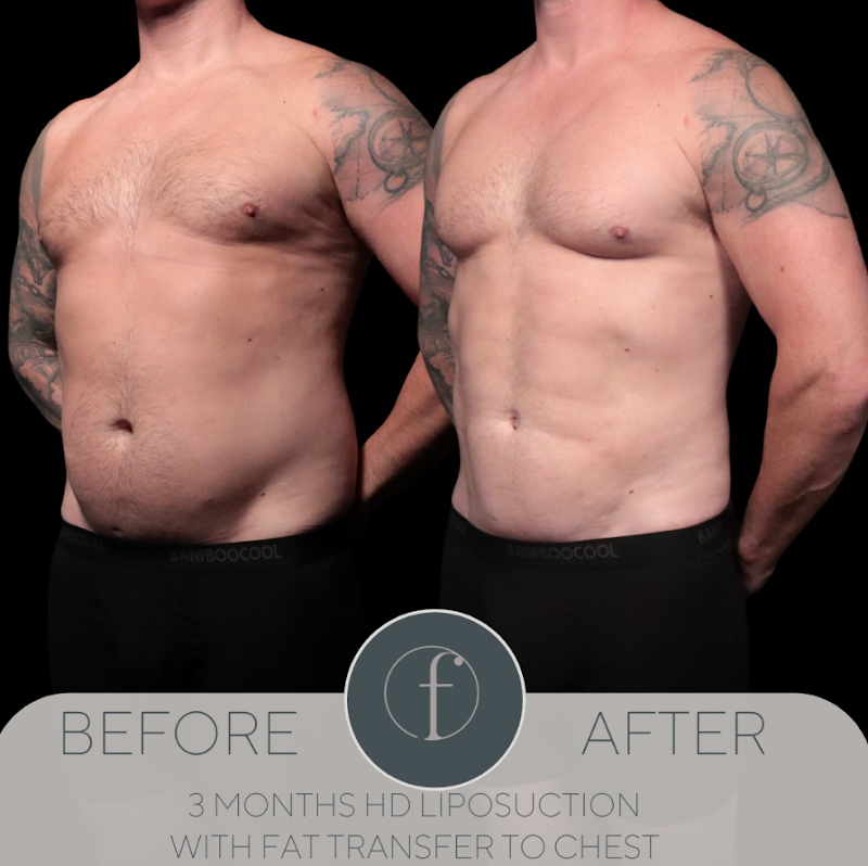 Formation by Dr. Gopal Grandhige - Tampa Plastic Surgery Clinic photo 2