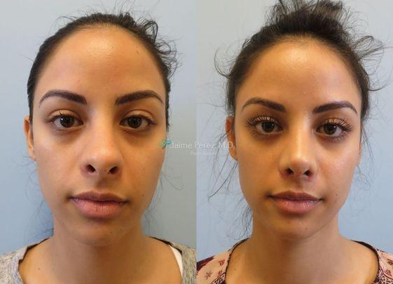 Plastic Surgery Center of Tampa - Jaime Perez, MD