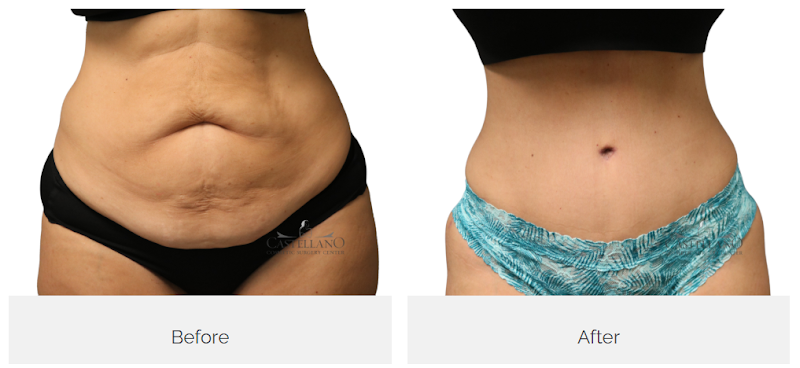 Castellano Cosmetic Surgery Center