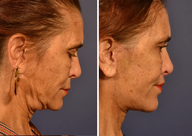 Narasimhan Plastic Surgery