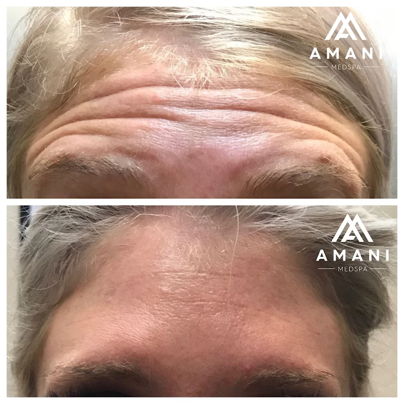 Amani Med Spa