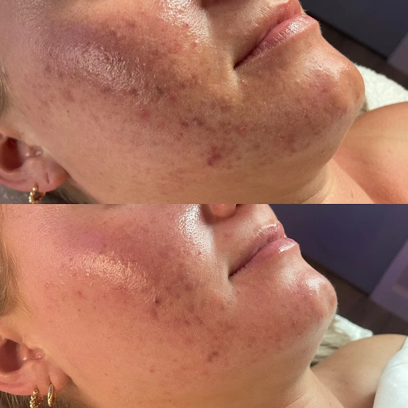 Skin Spa St Pete